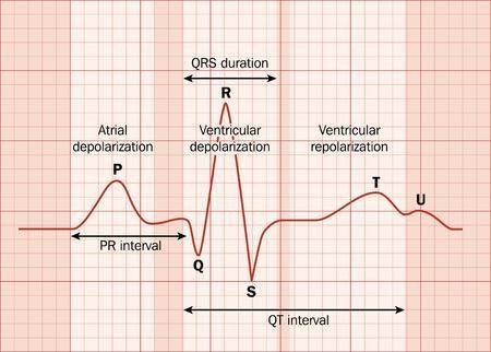 ECG